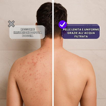 Acqua Pulse - Soffione Doccia